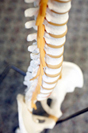 Image of dry spine